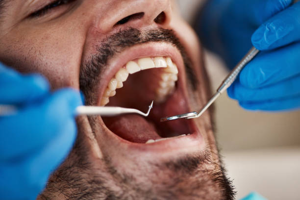 Best Emergency Dentist for Special Needs Patients in Candlewick Lake, IL
